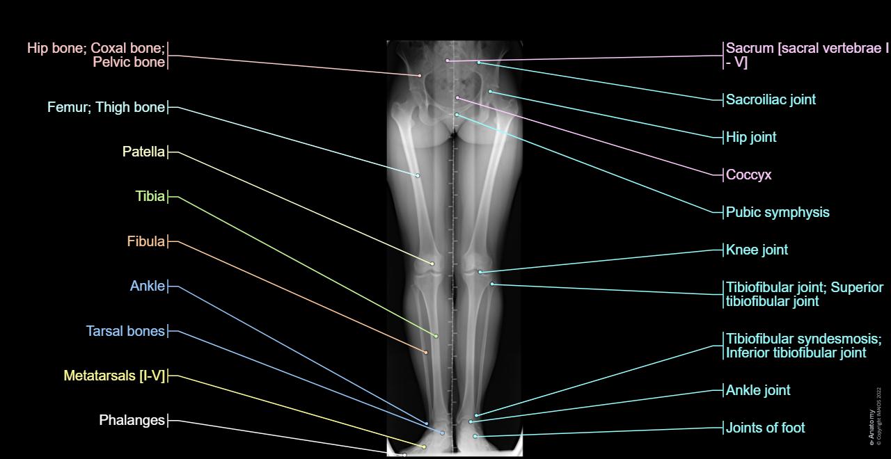 Radiological anatomy of the lower limb | e-Anatomy