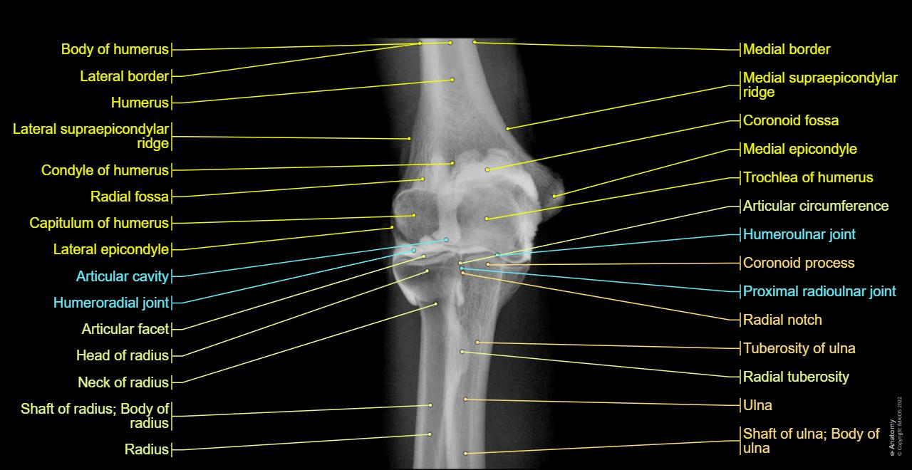 Ct Arhtrogram Machine Elbow CT arthrography: normal anatomy | e-Anatomy