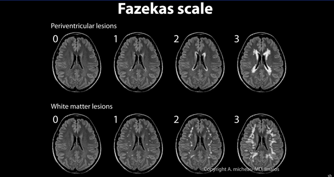 A glossary of commonly used classifications in medical imaging