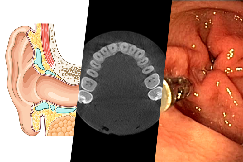 New modules added to our anatomy atlases