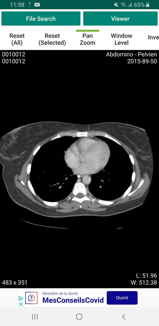 Dicom Ios Best mobile DICOM viewer (Android and iOS)