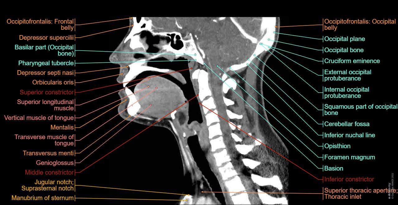Neck Study Neck Ct Anatomy NORMAL ANATOMY OF THE NECK WITH CT AND MR IMAGING