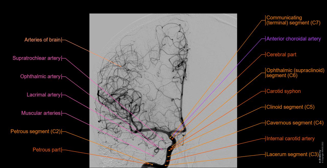 Normal Eca Angiogram Mri Brain Angio Anatomy Brain And Neck Arteries, 3D CT Angiogram