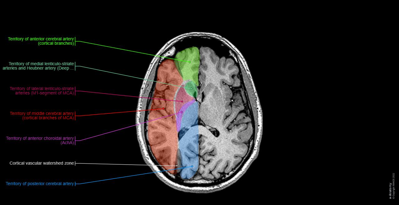 Brain MRI 3D: normal anatomy | e-Anatomy