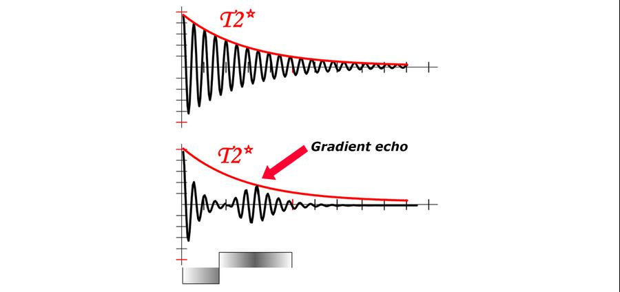 Mri Gradient Example MRI Sequences: gradient echo | e-MRI