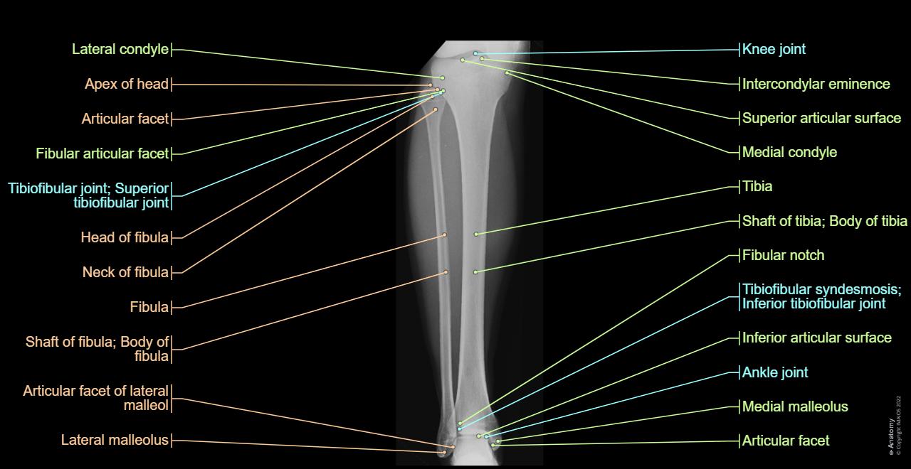 Lower Limb Alignment View Radiography Radiological anatomy of the lower limb | e-Anatomy