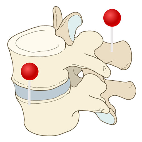 Anatomy of the spine and back: normal anatomy e Anatomy Anatomy of the spine and back: normal anatomy e Anatomy