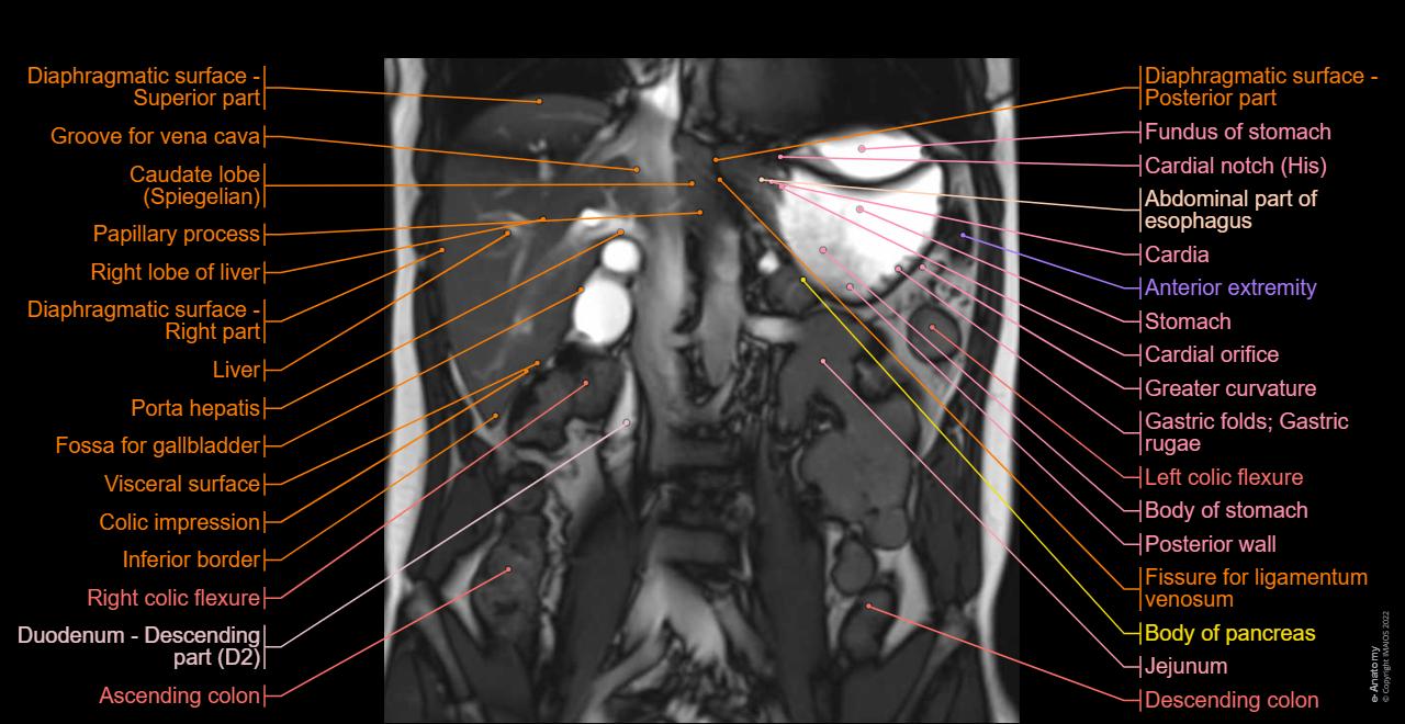 Normal Anatomy And Variants Mri Of The Liver Doctor normal-anatomy-and-variants-mri-of-the-liver-doctor