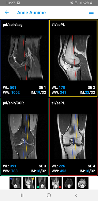 Dicom Ios Best mobile DICOM viewer (Android and iOS)