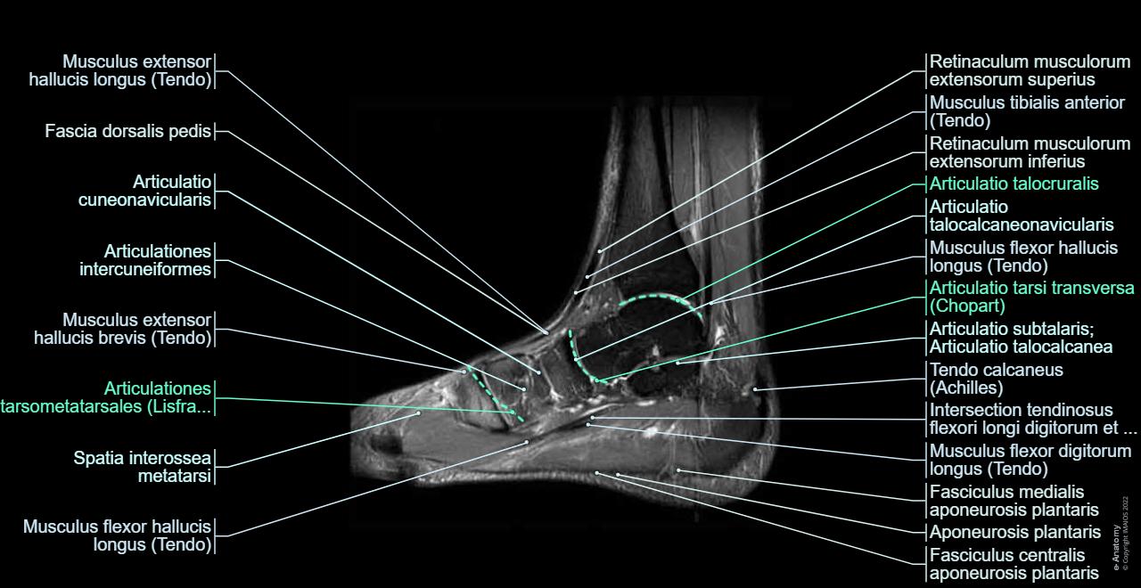 Sprunggelenk – Fuß MRT : normale anatomie | e-Anatomy