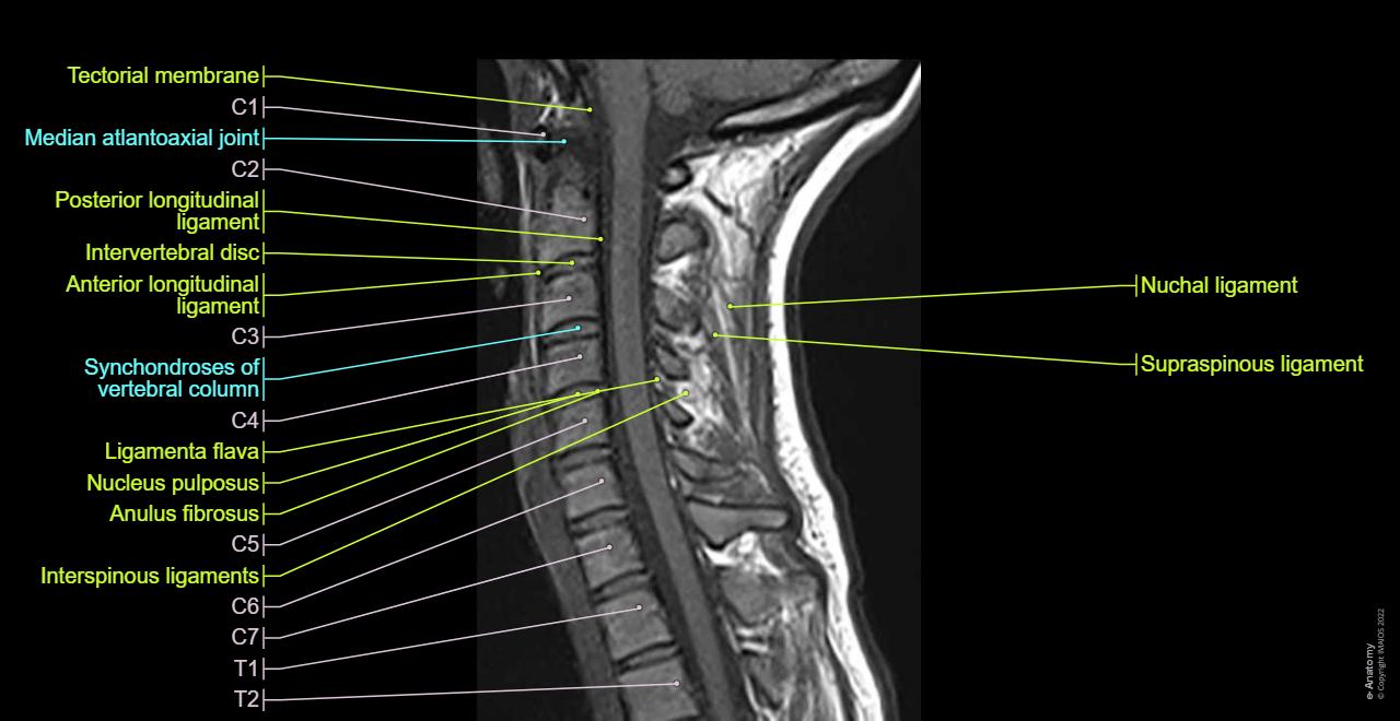 Normal Female Cervical Spine Mri Cervical Spine MRI With IV Contrast.