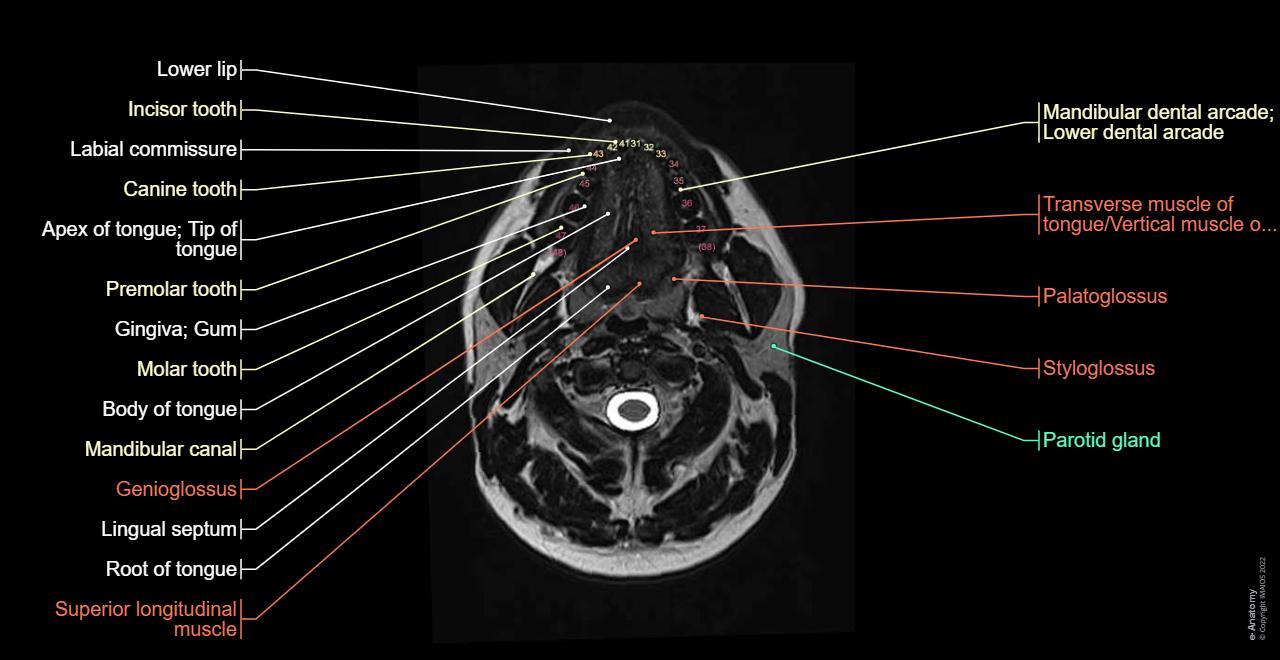 Anatomy of the face and neck (MRI) : normal anatomy | e-Anatomy