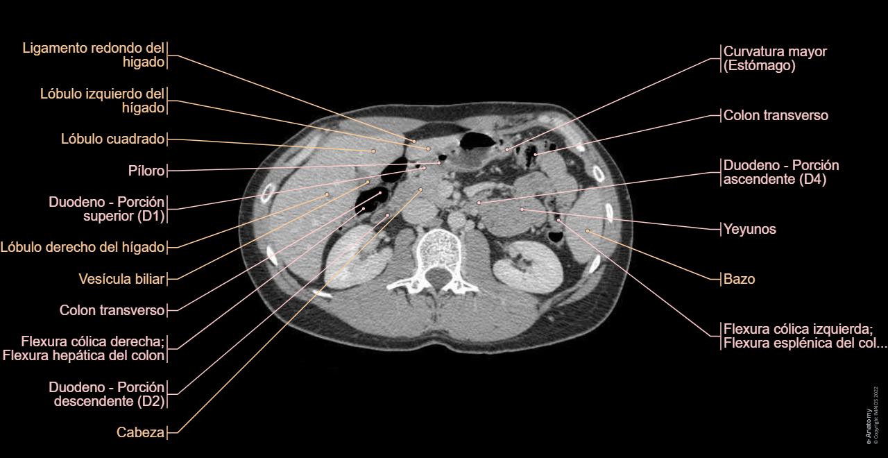 Tac Normal Anatomía De Corte Transversal Por Tomografía Computarizada Cortes