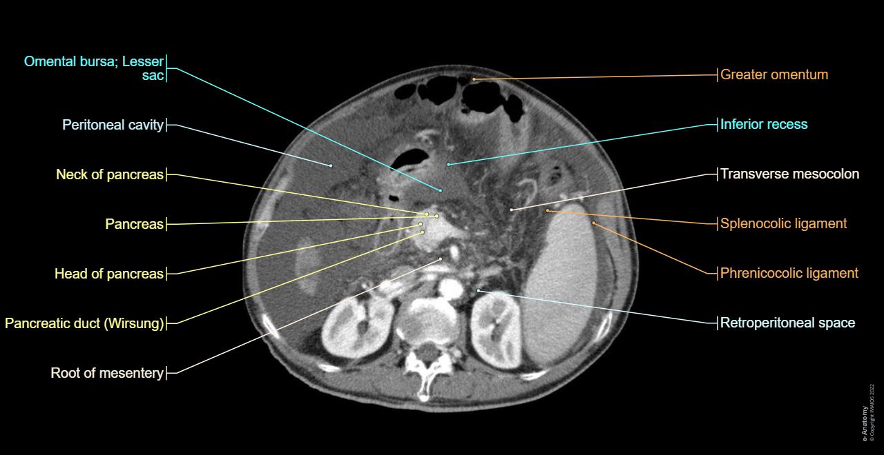 8 Peritoneal Cavity And Retroperitoneal Space Radiology Key 8-peritoneal-cavity-and-retroperitoneal-space-radiology-key