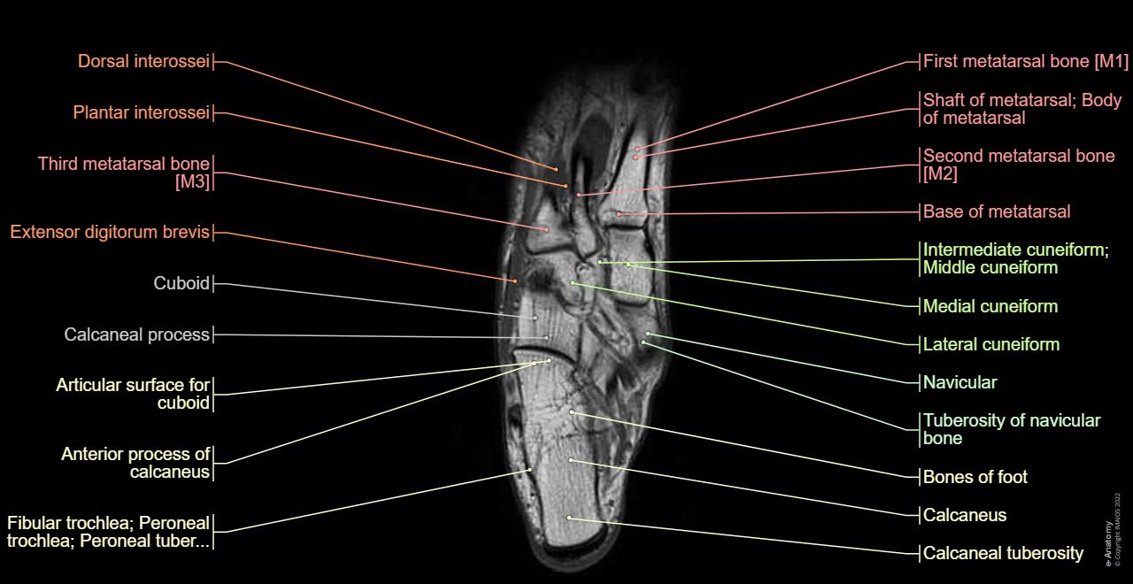 Anatomy of the foot and ankle - MRI | e-Anatomy