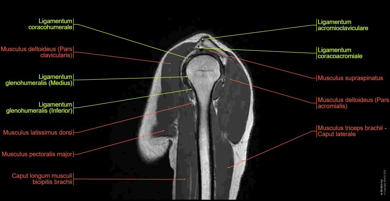 MRT der Schulter: normale anatomie | e-Anatomy
