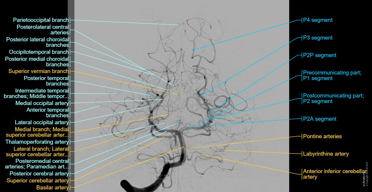 Arteries of brain Angiography: normal anatomy | e-Anatomy