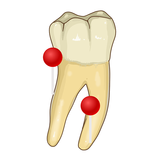 Anatomy of the teeth: 54 annotated illustrations with definitions | e ...
