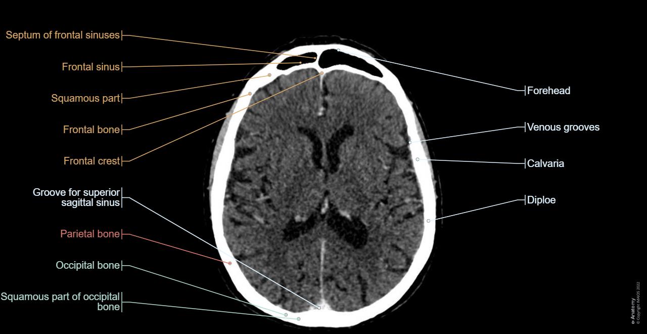 Ct Scan Head Anatomy Radiological Anatomy: X Ray, CT, MRI | Kenhub