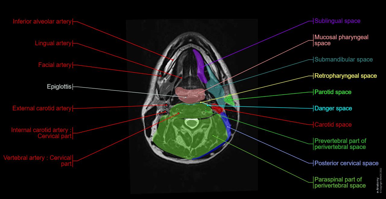 Anatomy of the face and neck (MRI) : normal anatomy | e-Anatomy