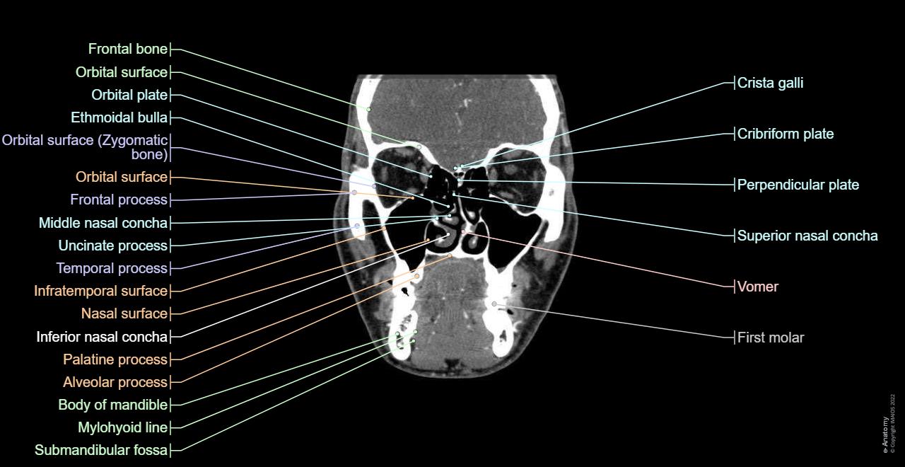 Scan atlas of anatomy of the face : normal anatomy | e-Anatomy