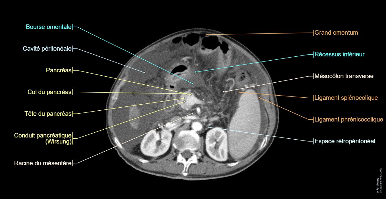 Cavit Abdominopelvienne Anatomie Normale E Anatomy cavit-abdominopelvienne-anatomie-normale-e-anatomy