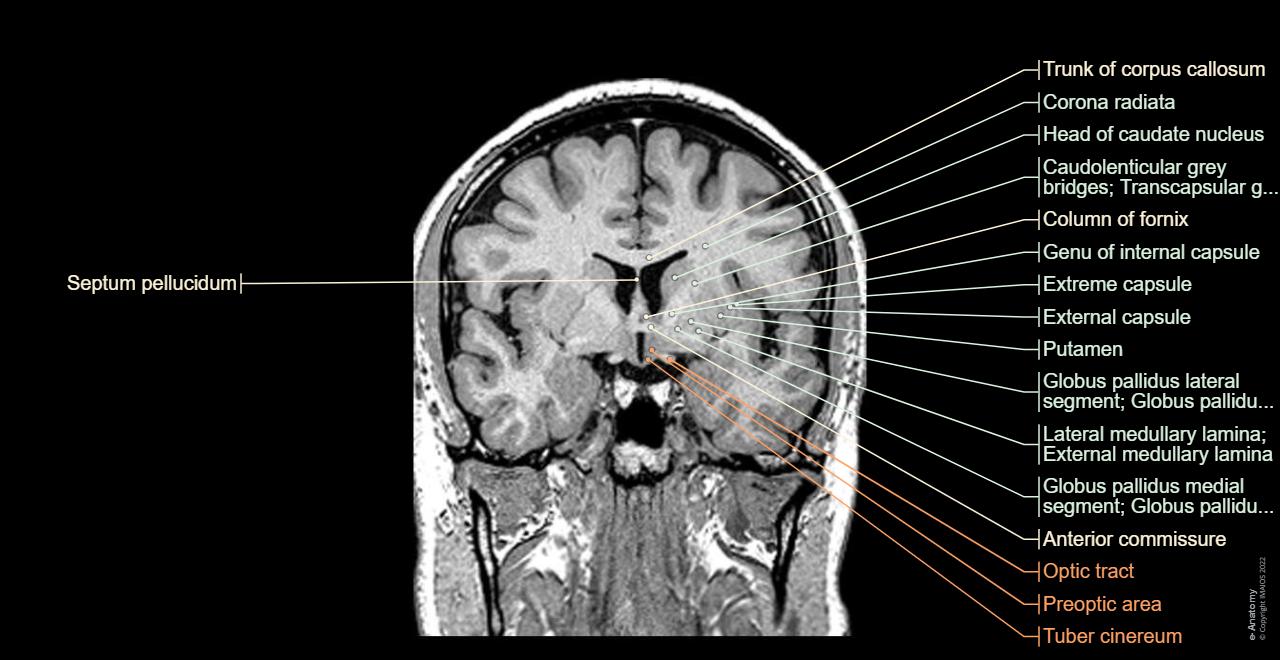 Cardunculus Brain Brain MRI 3D: normal anatomy | e-Anatomy