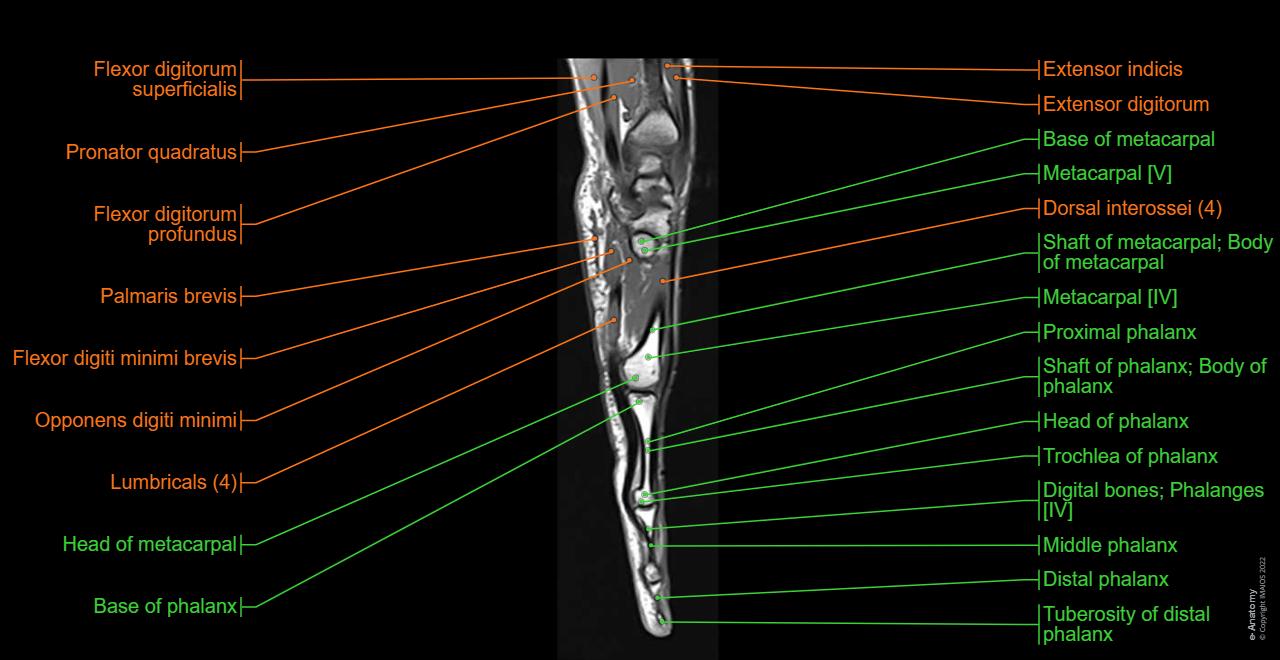 First Ray Hand The hand: normal anatomy | e-Anatomy