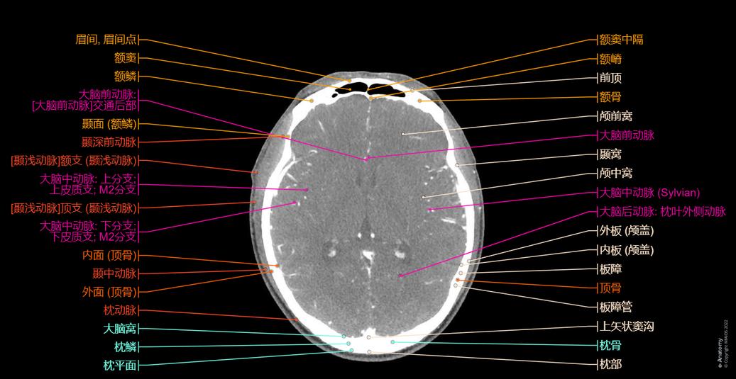 头和颈部 CT : 正常解剖 | e-Anatomy