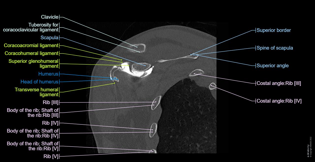 Ct Shoulder Anatomy