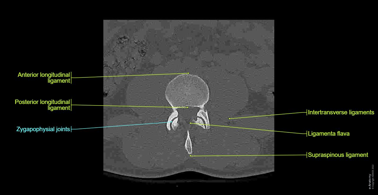 lumbar spine: normal anatomy | e-Anatomy