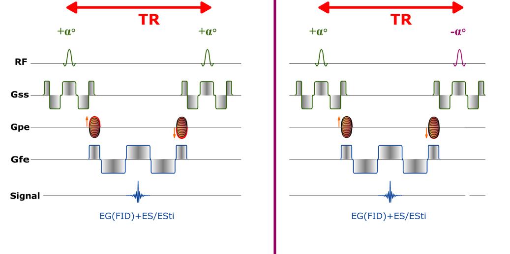 Eco Gradiente MRI Sequences: balanced gradient echo | e-MRI