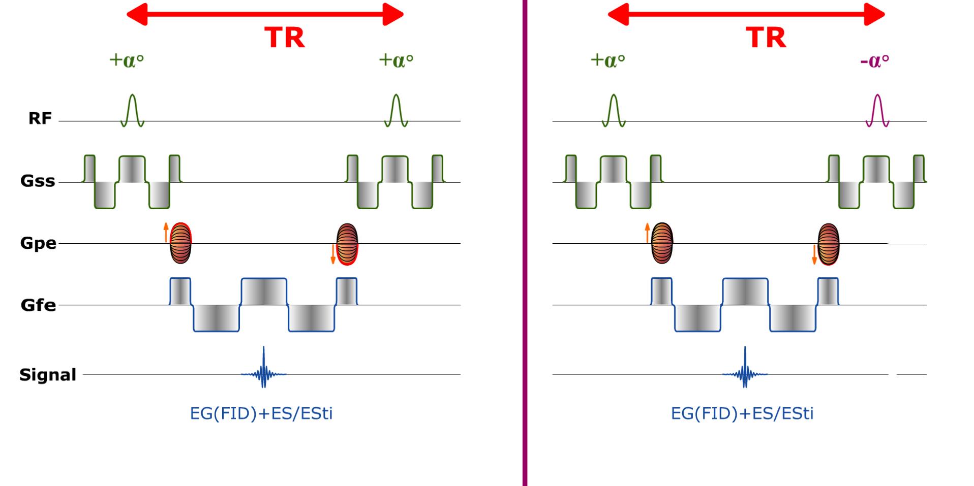 Mri Gradient Timing Séquences IRM : Echo de gradient à l'état d’équilibre et gradients ...
