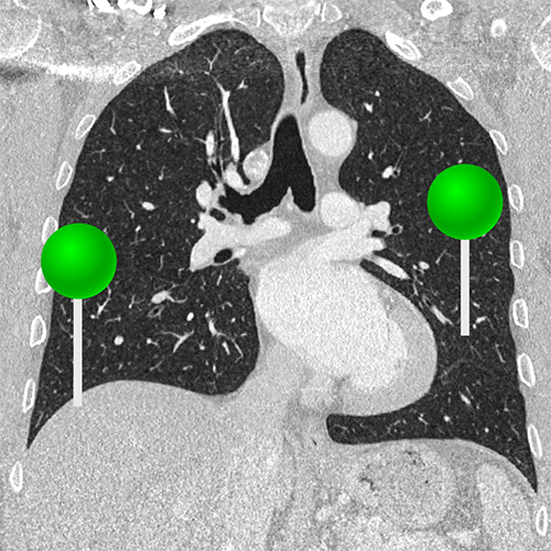 Anatomia Dos Pulm es Mediastino E Cora o Em TAC tomografia Tor cica anatomia-dos-pulm-es-mediastino-e-cora-o-em-tac-tomografia-tor-cica