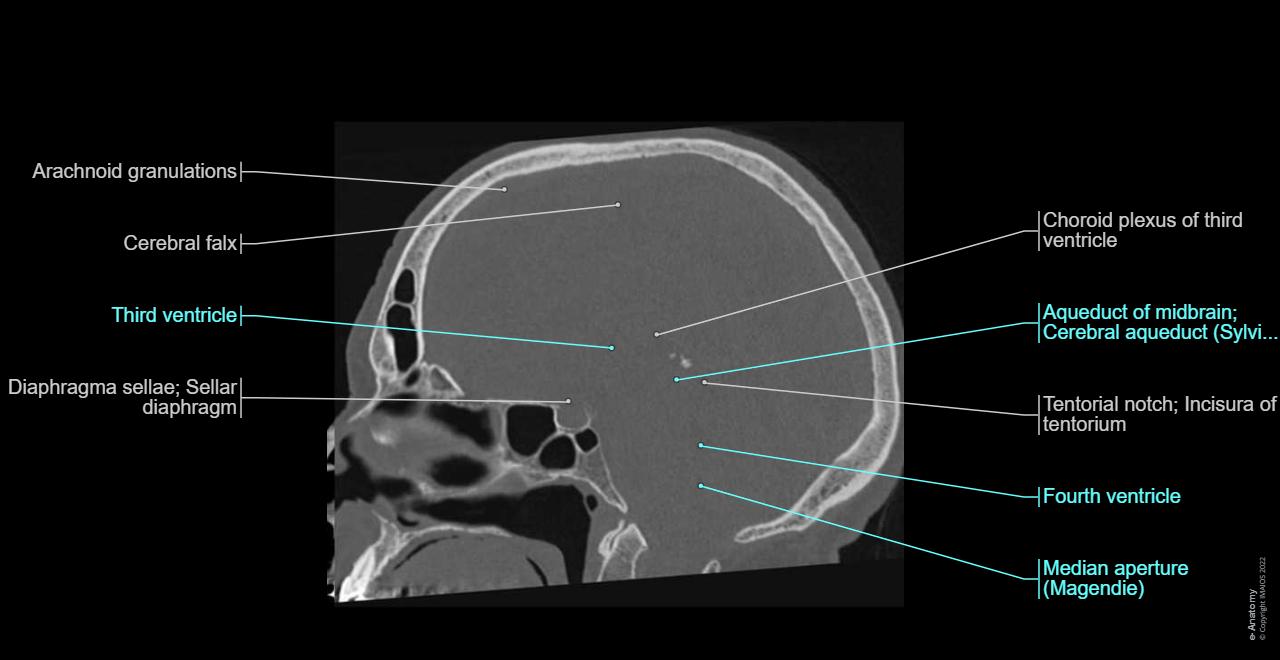 뇌와 얼굴의 해부학: CT 라벨 표시 - e-Anatomy