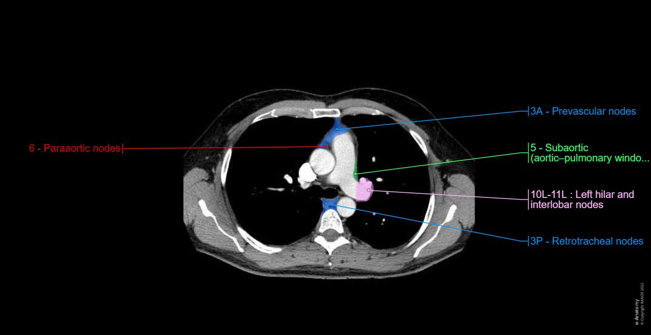 Scf Node Ct Scan Lymph nodes: normal anatomy | e-Anatomy