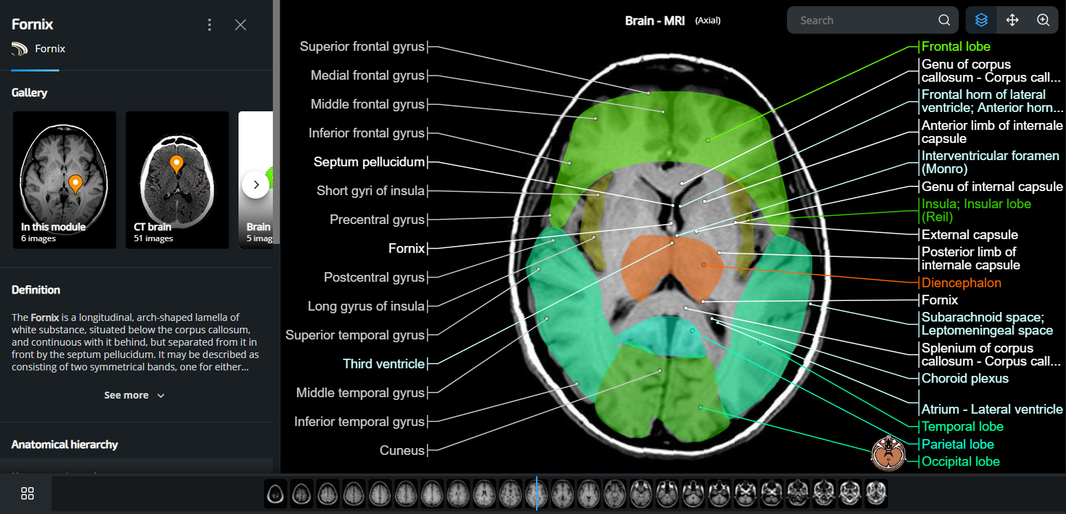 Tutorial for using e-Anatomy - IMAIOS