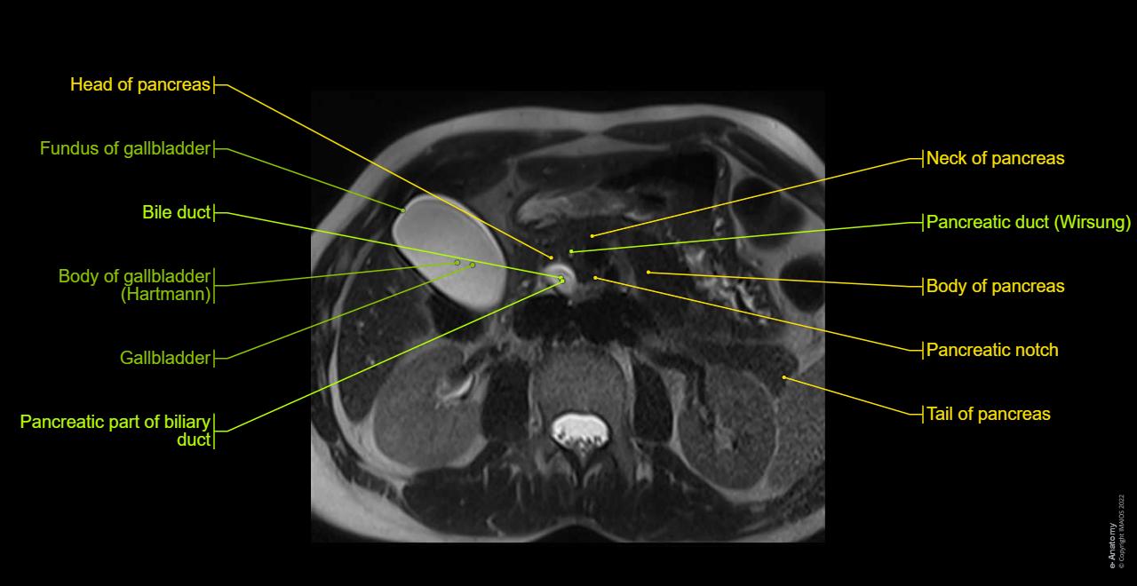 Magnetic Resonance Cholangiopancreatography: normal anatomy | e-Anatomy