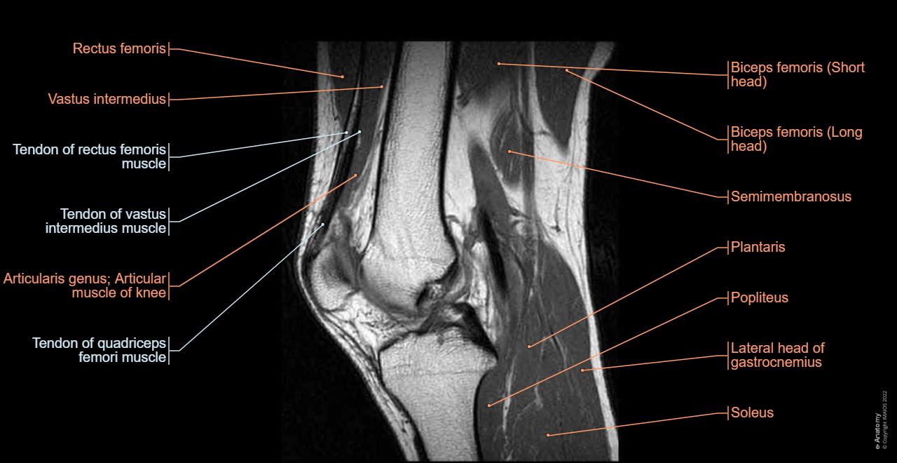 Knee Xray Anatomy Anatomy Of The Knee CT Arthrography E Anatomy knee-xray-anatomy-anatomy-of-the-knee-ct-arthrography-e-anatomy