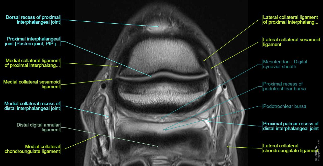 Foot and hoof anatomy of the horse on MRI: normal anatomy | vet-Anatomy