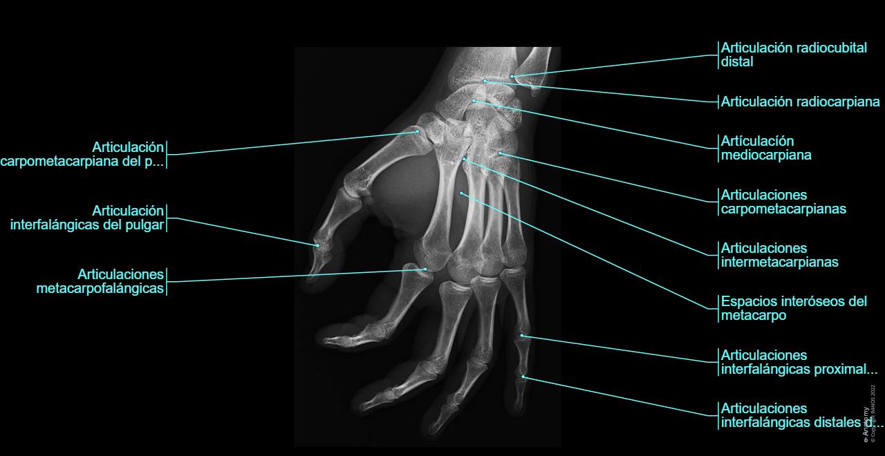 Anatomía De La Radiografía De La Muñeca