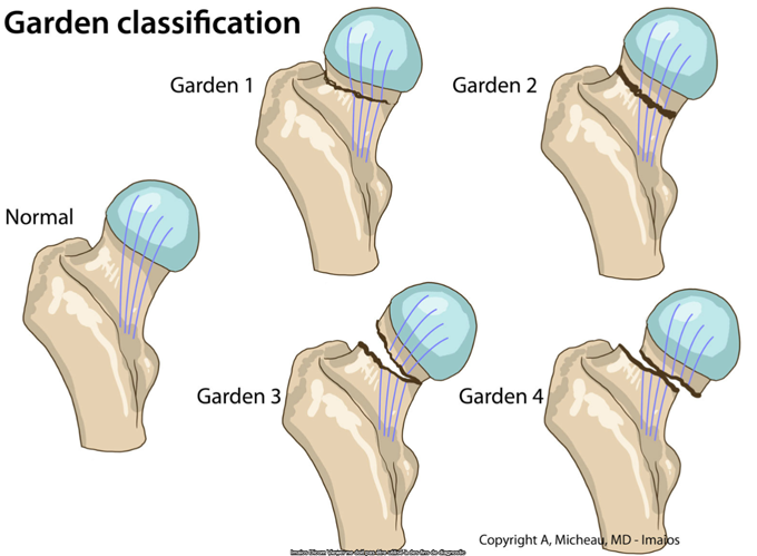 Scadding Radiological Classification A glossary of commonly used classifications in medical imaging