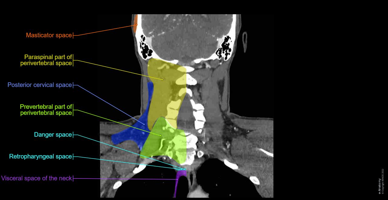 Neck Ct Anatomy