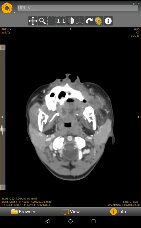 Best mobile DICOM viewer (Android and iOS)