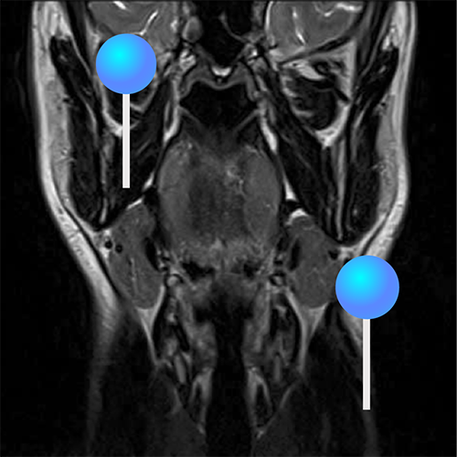 Anatomy of the face and neck (MRI) : normal anatomy | e-Anatomy