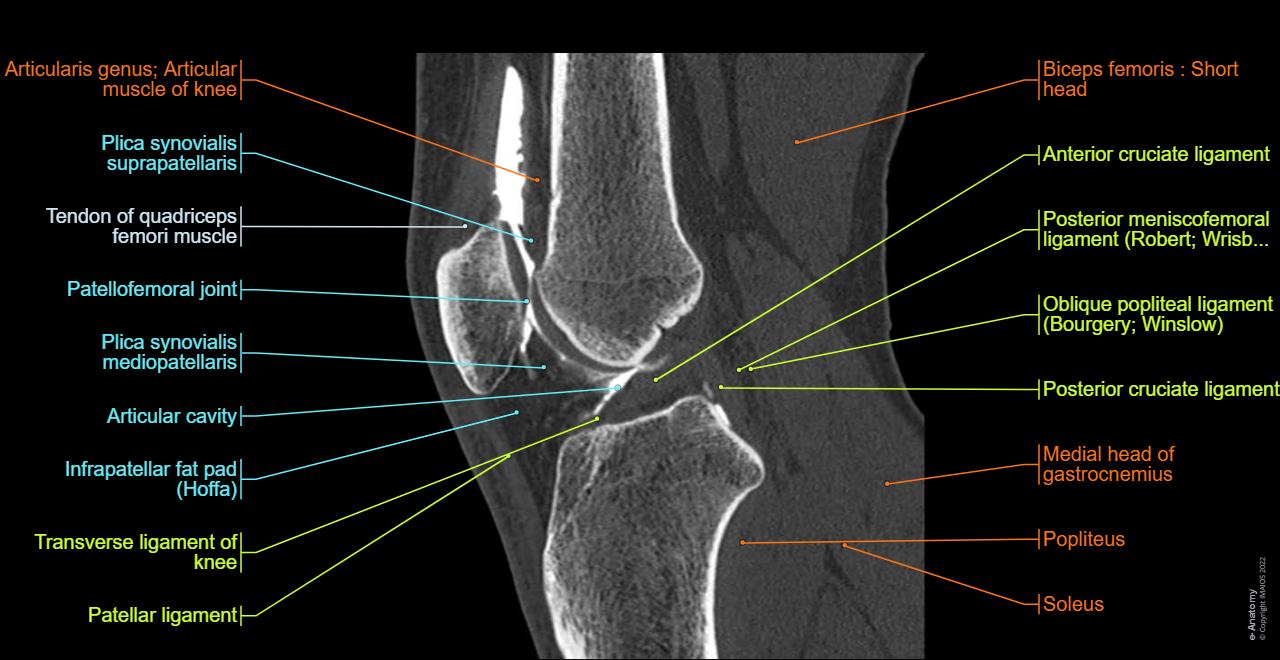 Shoulder Arthrogram Acl