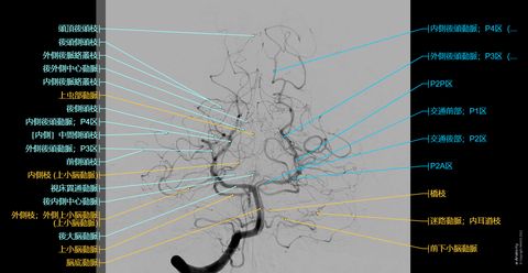 脳動脈 血管造影 : 正常解剖学 | e-Anatomy