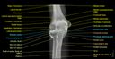 Elbow CT arthrography: normal anatomy | e-Anatomy