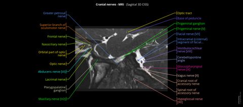 Navicular Cortex Mri Anatomy of the cranial nerves and brainstem: annotated MRI | e-Anatomy