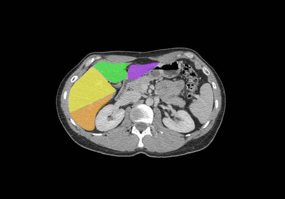 Abdomen and pelvis: normal anatomy | e-Anatomy